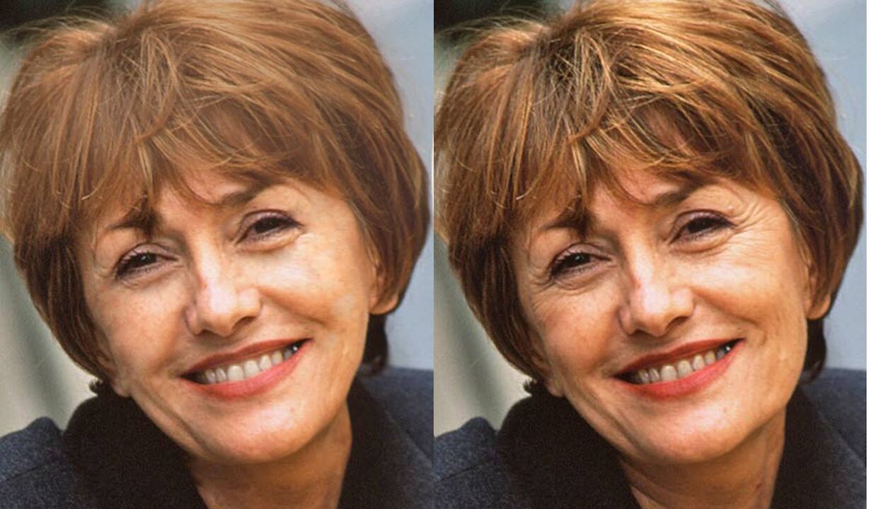 gambar wajah sebelum dan selepas kontur